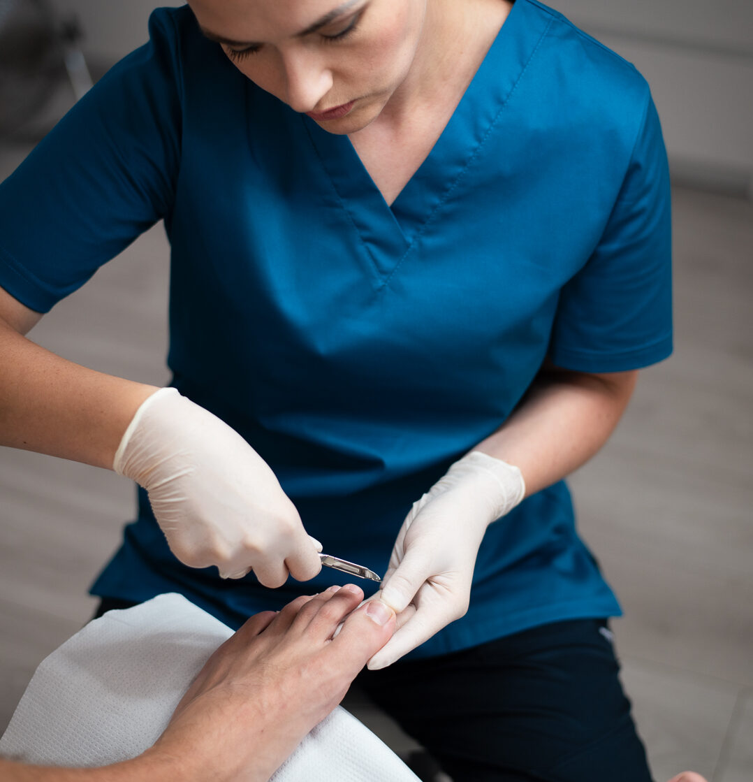 Wrastające paznokcie - jak sobie z nimi poradzić?